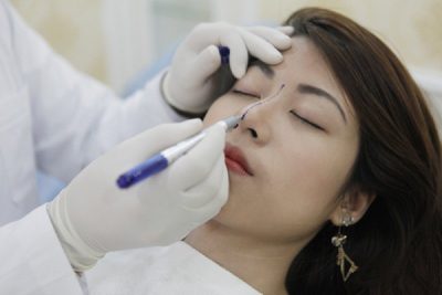 Chia sẻ kinh nghiệm xương máu trước khi phẫu thuật nâng mũi