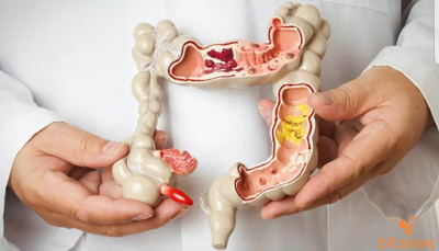 Ứng phó với bệnh co thắt đường ruột thường gặp ở trẻ em